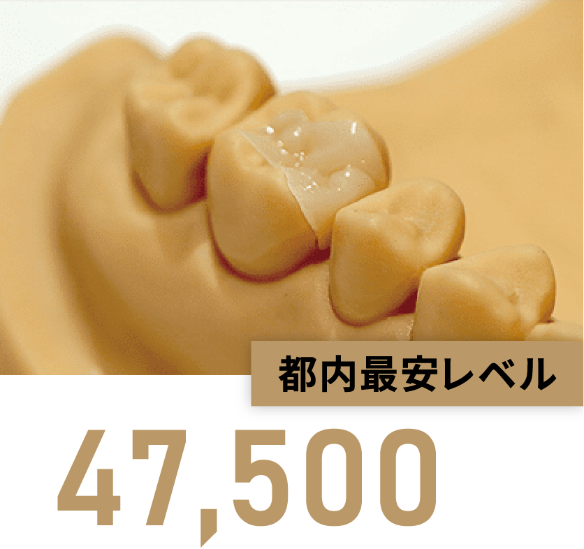 都内最安レベル【47,500円（税込）】※1