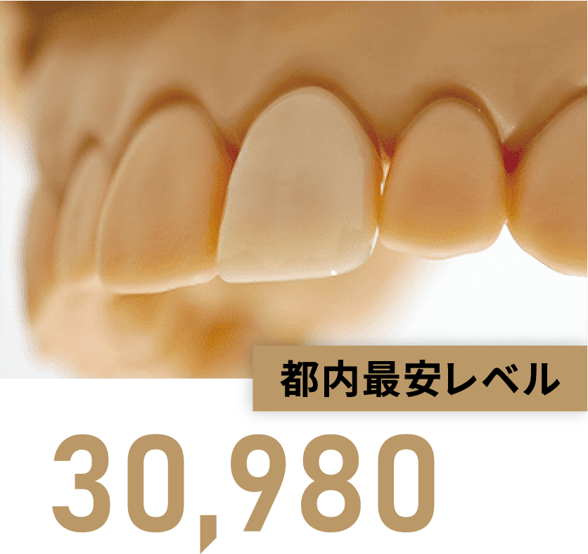 都内最安レベル【30,980円（税込）】※1※2